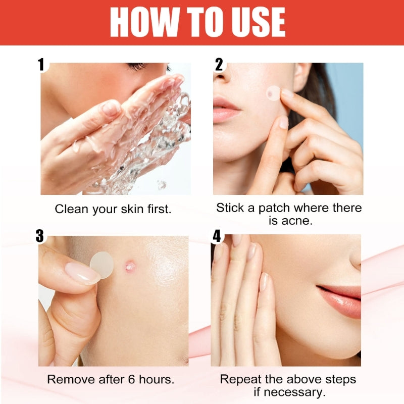 Hydrocolloid Acne Patches Pimple Stickers Removal Sticker Pimple Remover Blackhead Blemish Face Care